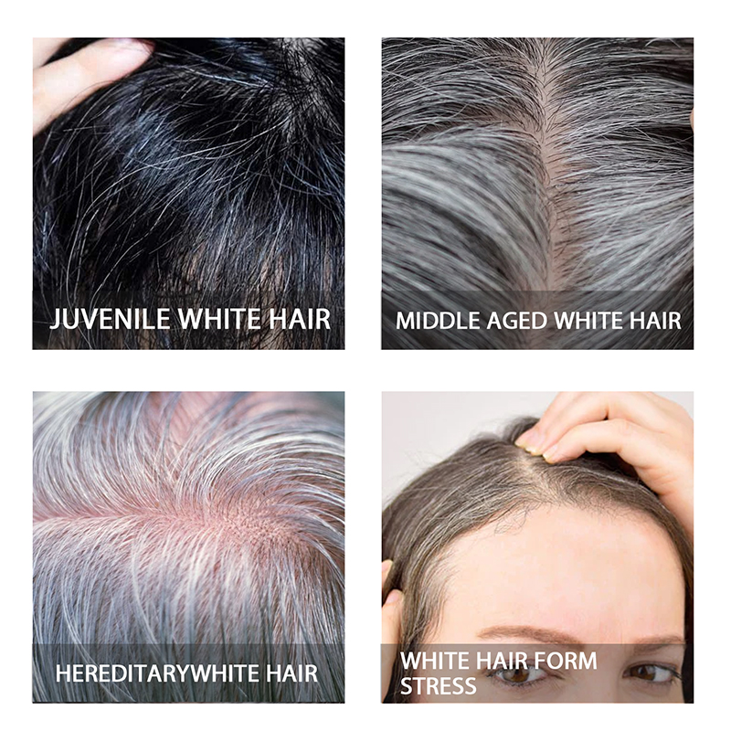 White Hair Treatment Darkening – Hair Care Normal Bewertung und Preis